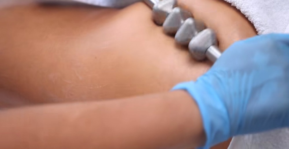 ダウンタイムケア